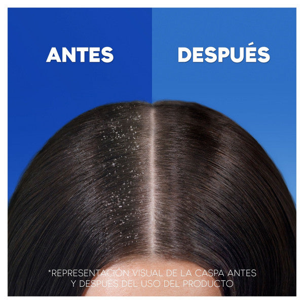 Shampoo Mentolo Rinfrescante - Head & Shoulders : 1000 ml - 6