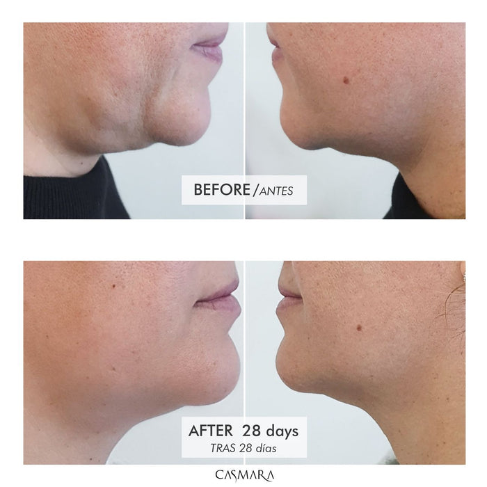 Crema Ristrutturante Tense-Lift 100ml - Casmara - 3