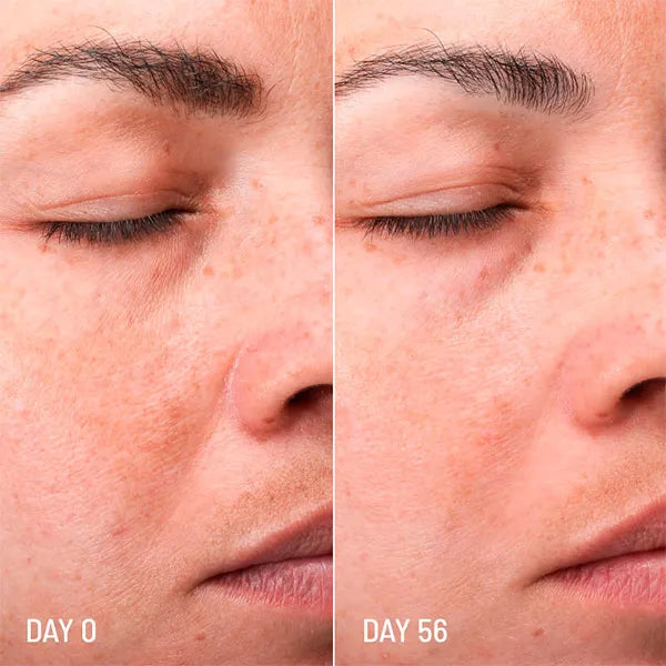 Crema Viso Sbiancante - Trattamento alle Macchie Scure Lotus Radiance 50ml - Freshly Cosmetics - 3