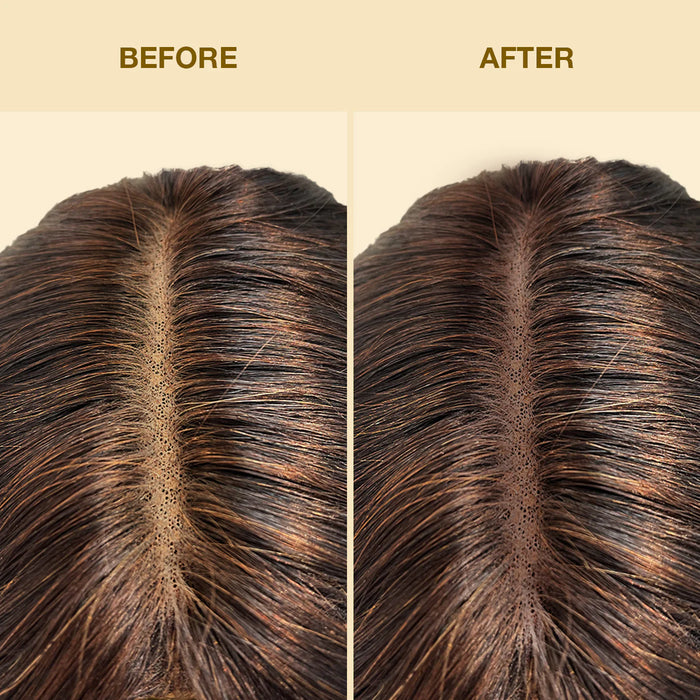 Spray Aerosol Tinto per Pizzo 80 ml - Ebin New York : Medium Dark Brown - 2